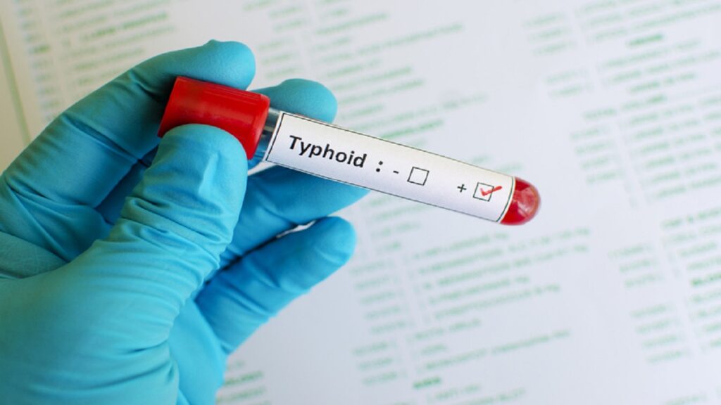 typhoid test positive